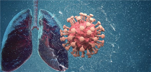 Das Coronavirus kann langfristig die Lunge schädigen: Ein chinesisches Forschungsteam wies dies bei Patienten, die zwei Jahre zuvor wegen COVID-19 stationär behandelt werden mussten, nach.