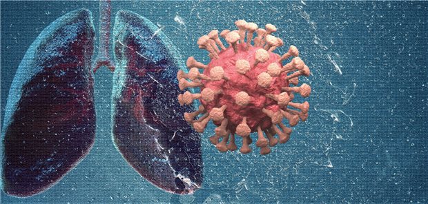 Das Coronavirus und die Lunge: COPD-Patienten sollten bei einer Infektion mit dem Coronavirus nicht einfach ihre Medikation ändern.