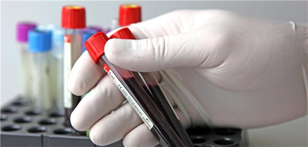 Eine Hand in Gummhandschuhen hält zwei Röhrchen mit Blut in der Hand. 