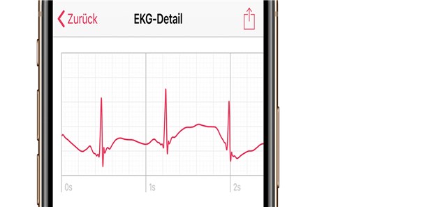Das EKG auf dem Smartphone.