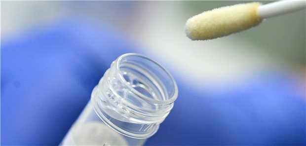 Das Ende der Abstrich-Zuschläge bei kurativen PCR-Tests empfinden Hausärzte als Missachtung.