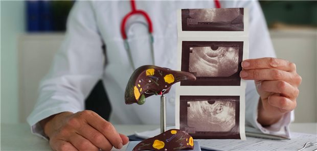 Ultraschallbilder der Unterusuchung der Leber in der menschlichen Bauchhöhle.