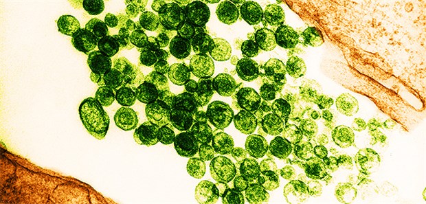 Das vergessene Virus Das HTLV-1 wurde vor fast vier Jahrzehnten entdeckt, die Erforschung stockt allerdings.