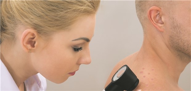 Zwei IGeL-Experten im Schlagabtausch Das Hautkrebsscreening ist für viele Patienten Kassenleistung. Mit Dermatoskop wird es zur IGeL.