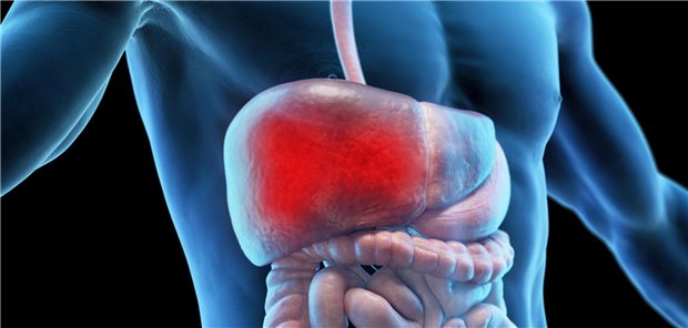 Das Hepatozelluläre Karzinom ist die häufigste Form von Leberkrebs und zählt mit rund 9.800 Neuerkrankungen pro Jahr zu den seltenen Krebserkrankungen.