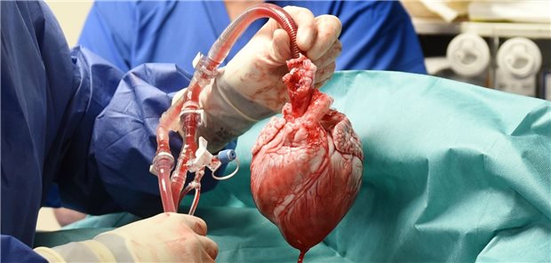 Herzchirurg: „Schweineherz-Transplantationen wird es wahrscheinlich auch bei uns geben“ Das Herz des genmodifizierten Schweins, bevor es einem 57-Jährigen in Baltimore transplantiert wurde.