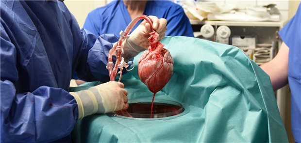 US-Patient mit Schweineherz ist tot: Ein kurzer Fall-Rückblick Das Herz des genmodifizierten Schweins, bevor es einem 57-Jährigen in Baltimore transplantiert wurde.