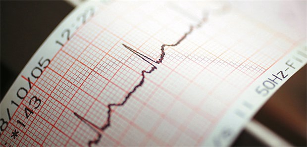 Strenge Risikokontrolle sichert Ablations-Erfolg Das Herz wieder in den richtigen Rhythmus bringen kann einie Ablation. Um den Erfolg langfristig zu erhalten, lohnt es sich, Risikofaktoren zu minimieren.