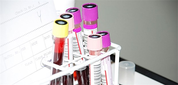 IGeL-Leistungen mit Augenmaß Das IGeL-Spektrum in den Praxen ist der Umfrage zufolge breit gefächert – mit zu den häufigsten Angeboten gehören allerdings Laboruntersuchungen.