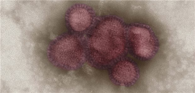 WHO veröffentlicht Empfehlungen für Influenza-Impfstoff für 2023 Das Influenzavirus – hier eingefärbt im Bild eine ältere Variante von H1N1 – verändert seine Strukturen regelmäßig. Deshalb müssen auch die Impfstoffe in jedem Jahr angepasst werden.