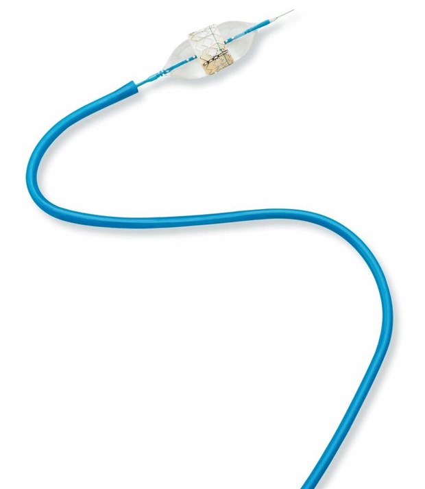 Stenosen von Aortenklappen minimal-invasiv geöffnet Das Klappenimplantat wird minimal-invasiv in die Aorta eingeführt. Die Herz-Lungen-Maschine wird nicht gebraucht.