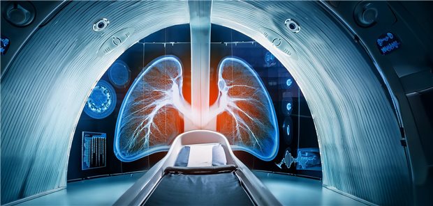 Das Lungenkrebs-Screening ist jetzt in Deutschland eine Kassenleistung für eine bestimmte Risikogruppe: ehemalige und aktive Starkraucher.