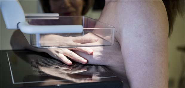 Das Mammographie-Screening-Programm hat zur frühzeitigen Detektion von Mammakarzinomen geführt, so das Bundesamt für Strahlenschutz. Aus seiner Sicht spricht auch in puncto Strahlenbelastung nichts gegen das Ausweiten der Zielgruppe auf Frauen der Altersgruppe 70 bis 75 Jahre.
