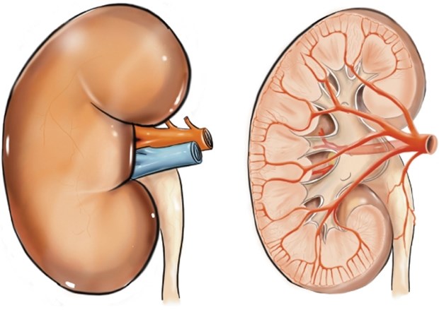 Kathetertherapie - neue Option bei resistenter Hypertonie? Das Nieren-Modell zeigt Arterien. Werden an Nierenarterien sympathische Nerven per Ablation ausgeschaltet, sinkt der Blutdruck.