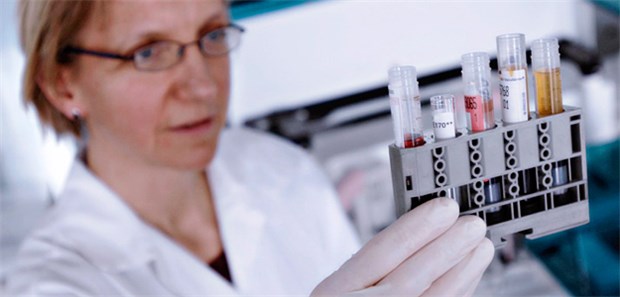 Prostata-Krebs wird seltener erkannt Das PSA-Screening zur Früherkennung von Prostata-Krebs ist umstritten.