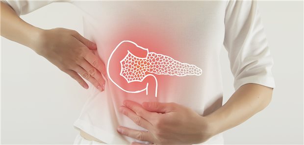 Das Pankreas im Blick: Unterschiedliche immunologische Reaktionen beeinträchtigen die Betazellen und können offenbar Diabetes verursachen oder befeuern.