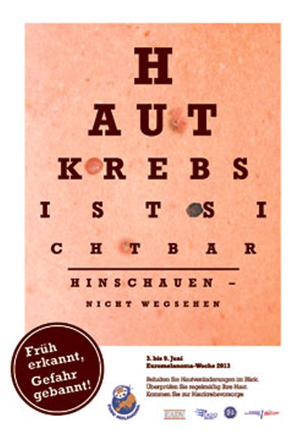 Früh erkannt, Gefahr gebannt Das Poster zur Euromelanoma-Woche 2013: Mehr als ein Sehtest.