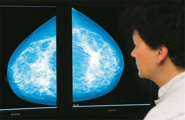 Ziel ist die vollständige medizinische und psychosoziale Rehabilitation Das Risiko für Brustkrebspatientinnen, ein kontralaterales Mamma-karzinom zu entwickeln, ist deutlich erhöht - daher sollte engmaschig mammografiert werden.