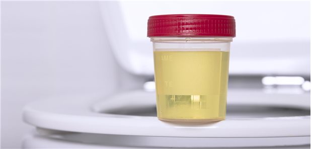 Das Risiko für Patienten, durch falsch positive toxikologische Tests von Urinproben zu Schaden zu kommen, lasse sich aber senken. Dafür müssten Ärzte, Patienten und Behörden die Urinproben für toxikologische Tests in geeigneter Weise behandeln, um alkoholische Gärung oder andere die toxikologischen Test beeinflussende Phänomene zu verhindern.