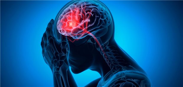 Dreidimensionale Illustration eines Mannes, der an kraniellen Ischämien leidet und deshalb Kopfschmerzen hat.