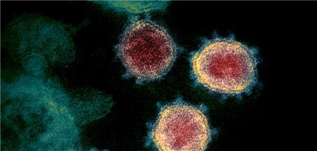 Die Besonderheiten des neuen Coronavirus Das SARS-CoV-2 hat mittlerweile fast 130.000 Menschen weltweit nachweislich infiziert.