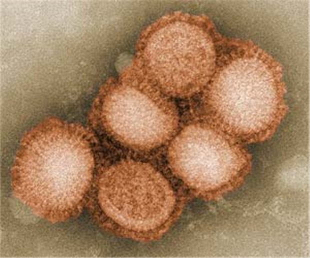 Jeder zehnte Schweinegrippe-Patient über 70 Jahre stirbt an der Infektion Das Schweinegrippe-Virus unter dem Mikroskop.