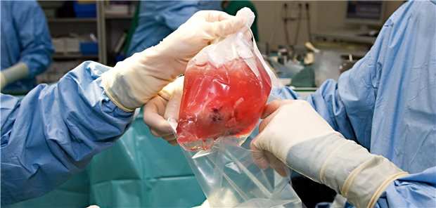 Das Spenderorgan fest in der Hand: Die Entnahme muss bereits wenige Stunden nach dem Tod des Patienten stattfinden.