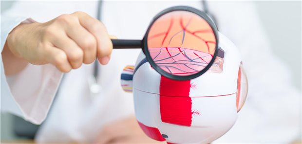 Ein Arzt mit einem Modell des menschlichen Auges hebt mit einer Lupe die Netzhaut hervor, die im Rahmen einer Makuladegeneration beschädigt wird.