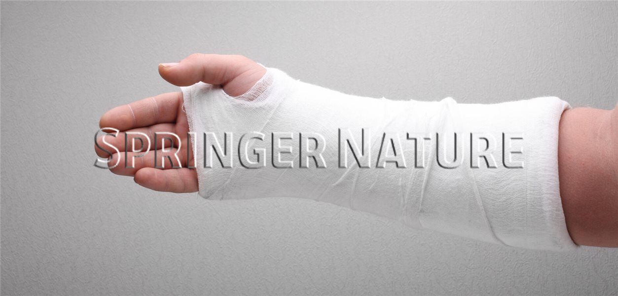 Distale Radiusfraktur Gips Oder Schiene