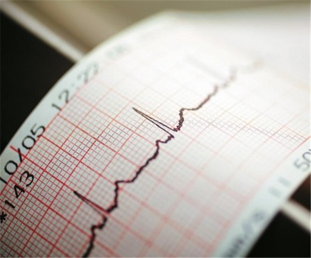 Katheterablation erfolgreich gegen Vorhofflimmern Das Therapieziel: normaler Herzrhythmus © emeraldphoto / fotolia.com