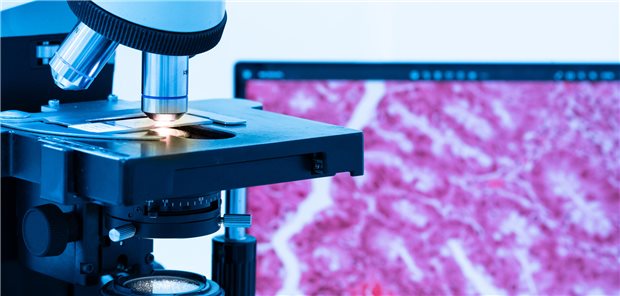 Das Virchow KI-Modell kann Biomarker vorhersagen und Krebsarten nur anhand histopathologischer Proben identifizieren.