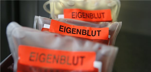 Das deutsche Anti-Doping-Gesetz verbietet auch das Doping mit Eigenblut.