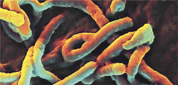 Das digital gefärbte Rasterelektronenmikroskopie(REM)-Bild zeigt ein einzelnes fadenförmiges Ebola-Viruspartikel.