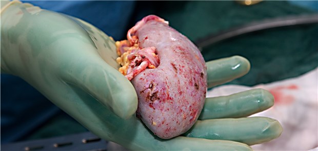 So viele Organe werden gespendet – und benötigt Das gespendete Organ für einen Nierenkranken.