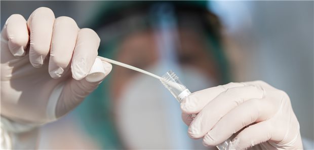 Anzahl der PCR-Tests sank um Weihnachten deutlich Das hat es „Knick“ gemacht: Abstrich für eine SARS-CoV-2-PCR-Testung.