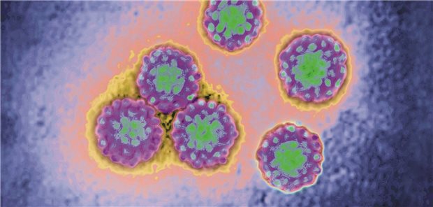 Das humane Papillomavirus (HPV) – hier im Elektronenmikroskop – verursacht sexuell übertragbare Krankheiten wie Genitalwarzen oder Zervixkarzinomen.