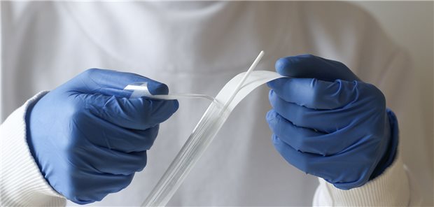 Das klinische Bild ist eindeutig, der Patient oder die Patientin hat sich bereits selbst positiv getestet, die Symptome sind mild – jetzt noch einen Abstrich machen und einen PCR-Test draufsetzen? Viele Ärzte sehen das kritisch.