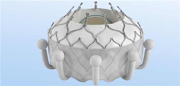 Das neue System zum Ersatz zur Trikuspidalklappe (Evoque), entwickelt von der Firma Edwards Lifesciences.