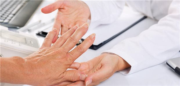 Das schwedische Forschungsteam um Lotta Ljung von der Universität Umeå resümiert, dass extraartikuläre Manifestationen noch immer eine wichtige Ursache von Morbidität und Mortalität bei Patienten mit rheumatoider Arthritis sind.