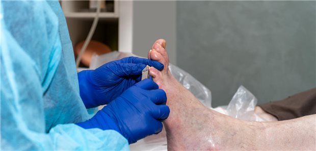 Ein medizinischer Pfleger schneidet einem älteren Patienten in der Klinik die langen Fußnägel.