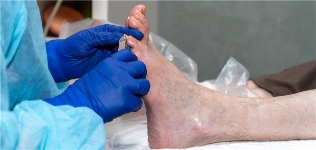 Ein medizinischer Pfleger schneidet einem älteren Patienten in der Klinik die langen Fußnägel.