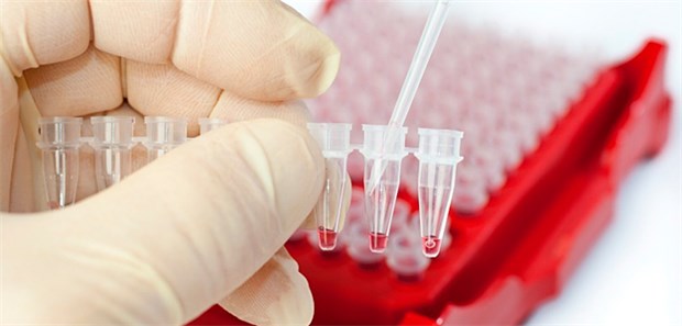 DNA-Codes aller Menschen in Deutschland erfassen Datenschutz versus Verbrechensaufklärung: Rechtsmediziner fordert DNA-Erfassung aller Menschen in Deutschland.