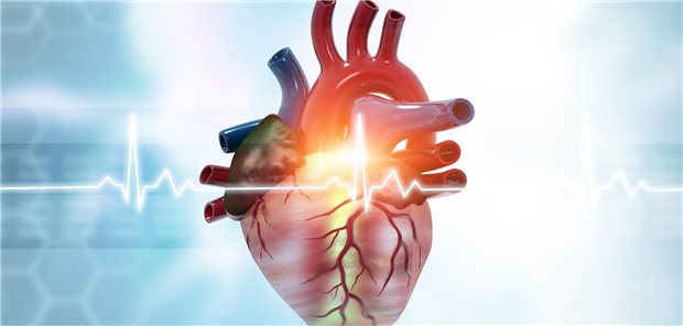 Dauerhafte Herzschäden durch COVID? Zwei Studien sind diesbezüglich zu unterschiedlichen Ergebnissen gekommen.