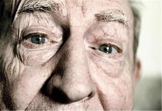 Hirnliga fordert bessere Behandlung von Demenzkranken Demenzkranke brauchen alle zur Verfügung stehende Therapie-Optionen. Dafür macht sich die Hirnliga stark.