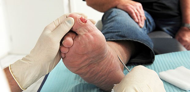Fußnetz Bayern hat hohe Ziele Den diabetischen Fuß in den Griff zu kriegen ist das Ziel des IV-Projekts Fußnetz Bayern.