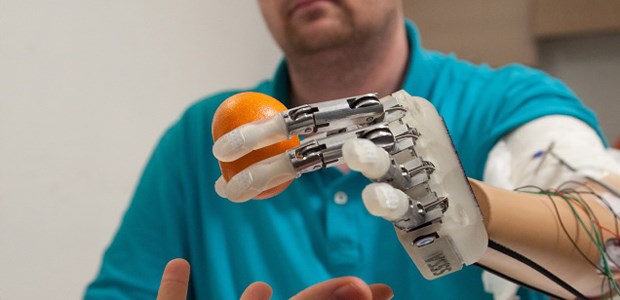 Mit der Kunsthand fühlen und tasten Dennis Aabo Sørensen mit seiner neuartigen Handprothese.