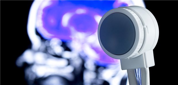 Der 3D-Matrix-Ultraschalltransducer für die transkranielle Neurostimulation ist in der Lage, exakt bestimmte Punkte in der Tiefe des Gehirns zu stimulieren. Somit ist ein Einsatz bei vielen neurologischen Krankheitsbildern denkbar.