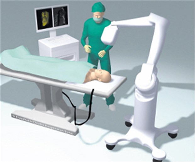 3D-Bilder im OP ohne viel Aufwand Der 3D-Röntgenscanner ORBIT macht während einer Op Bildaufnahmen ohne zeitintensive Vorbereitung möglich.