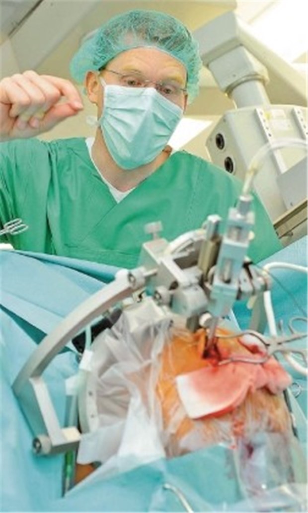 Neuer Schrittmacher lindert zugleich Tremor, Rigor und Akinese bei Parkinson-Patienten Der 49-jährige Patient wird operiert. Ärzte erwarten, dass der neue Schrittmacher (unten) alle drei Kardinalsymptome bei Parkinson reduziert.