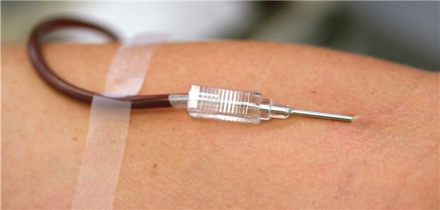 Der Aderlass wird im EBM mit 165 Punkten bewertet.